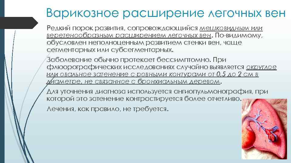 Варикозное расширение легочных вен Редкий порок развития, сопровождающийся мешковидным или веретенообразным расширением легочных вен.