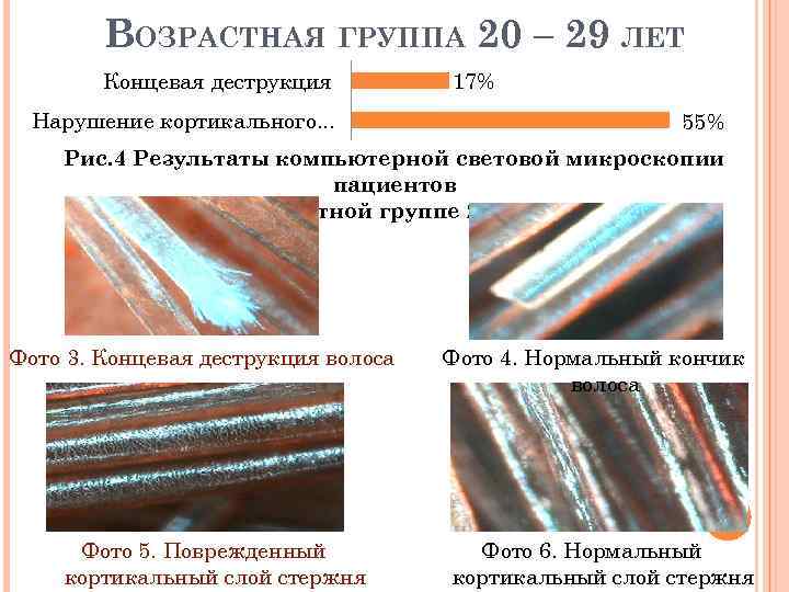 ВОЗРАСТНАЯ ГРУППА 20 – 29 ЛЕТ Концевая деструкция Нарушение кортикального. . . 17% 55%
