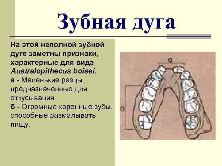 Зубная дуга На этой неполной зубной дуге заметны признаки, характерные для вида Australopithecus boisei.