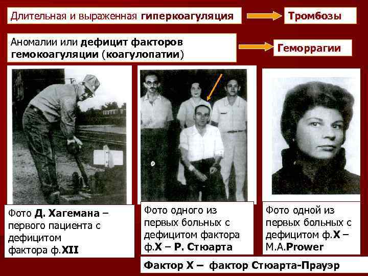 Длительная и выраженная гиперкоагуляция Аномалии или дефицит факторов гемокоагуляции (коагулопатии) Фото Д. Хагемана –