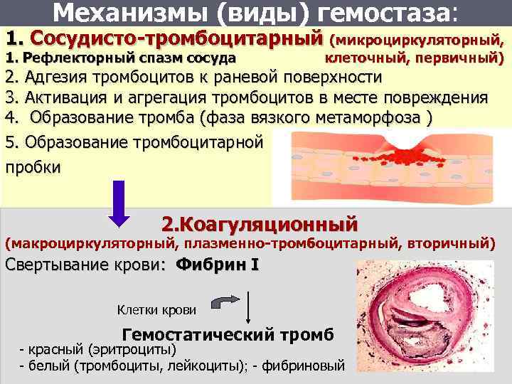 Механизм тромбоза. Сосудисто-тромбоцитарный гемостаз механизм. Схема тромбоцитарного и коагуляционного гемостаза. Первичный гемостаз тромб. Механизмы свертывания крови: первичный (тромбоцитарный).