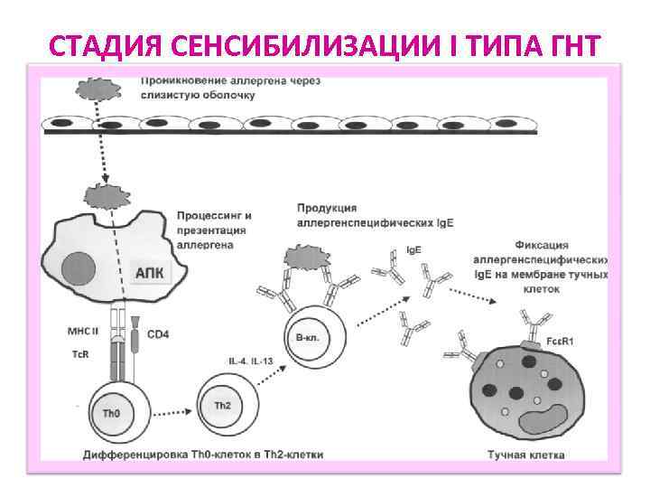 СТАДИЯ СЕНСИБИЛИЗАЦИИ I ТИПА ГНТ 