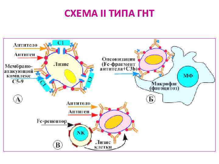 Схема гиперчувствительности 2 типа