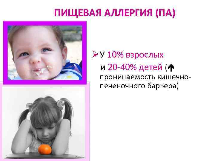 ПИЩЕВАЯ АЛЛЕРГИЯ (ПА) Ø У 10% взрослых и 20 -40% детей ( проницаемость кишечнопеченочного