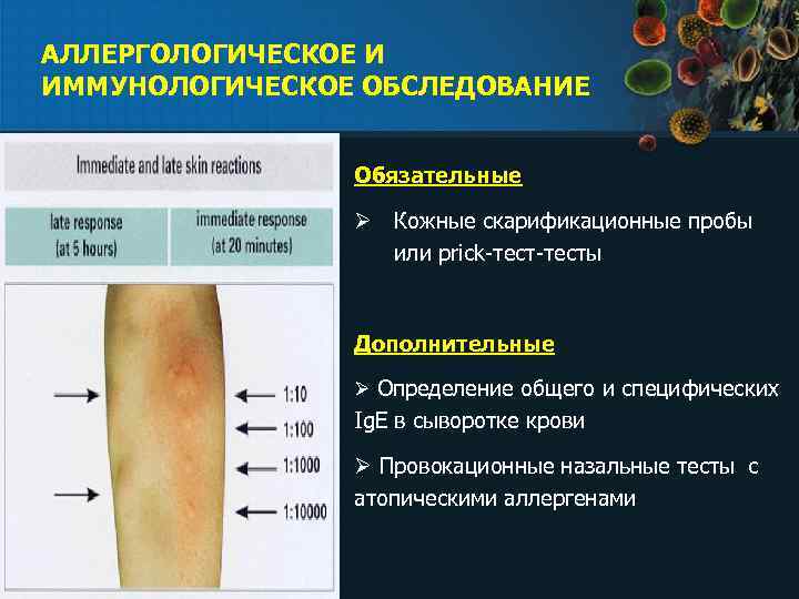 АЛЛЕРГОЛОГИЧЕСКОЕ И ИММУНОЛОГИЧЕСКОЕ ОБСЛЕДОВАНИЕ Обязательные Ø Кожные скарификационные пробы или рrick-тесты Дополнительные Ø Определение