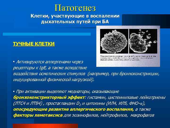 Патогенез Клетки, участвующие в воспалении дыхательных путей при БА ТУЧНЫЕ КЛЕТКИ • Активируются аллергенами