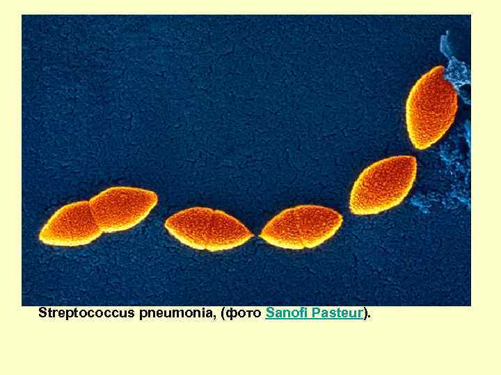 Streptococcus pneumonia, (фото Sanofi Pasteur). 