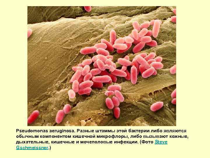 Pseudomonas aeruginosa. Разные штаммы этой бактерии либо являются обычным компонентом кишечной микрофлоры, либо вызывают