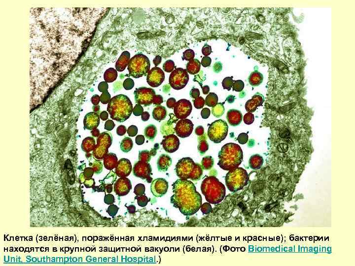 Клетка (зелёная), поражённая хламидиями (жёлтые и красные); бактерии находятся в крупной защитной вакуоли (белая).