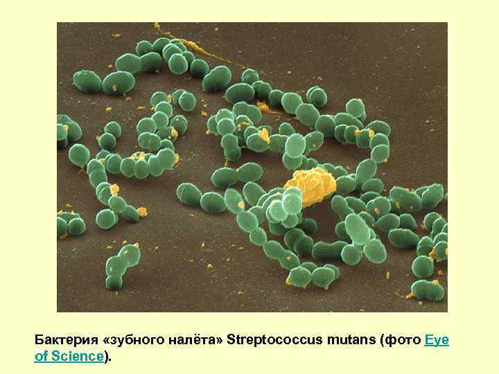 Бактерия «зубного налёта» Streptococcus mutans (фото Eye of Science). 