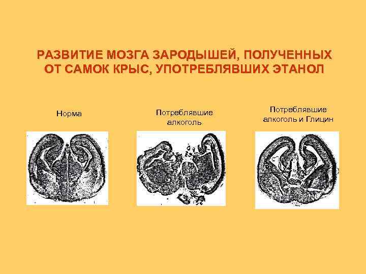 РАЗВИТИЕ МОЗГА ЗАРОДЫШЕЙ, ПОЛУЧЕННЫХ ОТ САМОК КРЫС, УПОТРЕБЛЯВШИХ ЭТАНОЛ Норма Потреблявшие алкоголь и Глицин