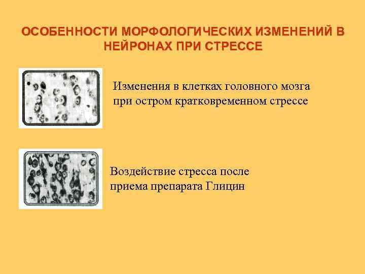 ОСОБЕННОСТИ МОРФОЛОГИЧЕСКИХ ИЗМЕНЕНИЙ В НЕЙРОНАХ ПРИ СТРЕССЕ Изменения в клетках головного мозга при остром