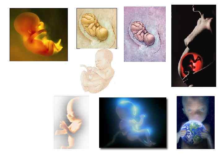 Внутриутробное недоразвитие головного мозга. Тератогенез тератогенные факторы. Внутриутробные пороки развития. Влияние на зародыш внешних факторов. Пороки развития эмбриона.