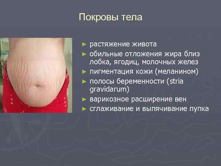 Покровы тела растяжение живота ► обильные отложения жира близ лобка, ягодиц, молочных желез ►