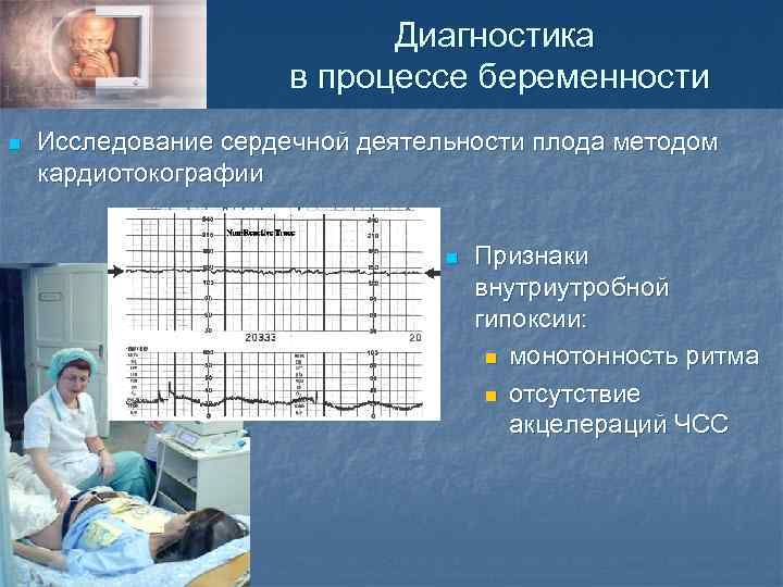 Диагностика в процессе беременности n Исследование сердечной деятельности плода методом кардиотокографии n Признаки внутриутробной