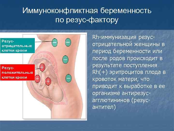 Иммуноконфликтная беременность по резус-фактору Резусотрицательные клетки крови Резусположительные клетки крови Rh-иммунизация резусотрицательной женщины в