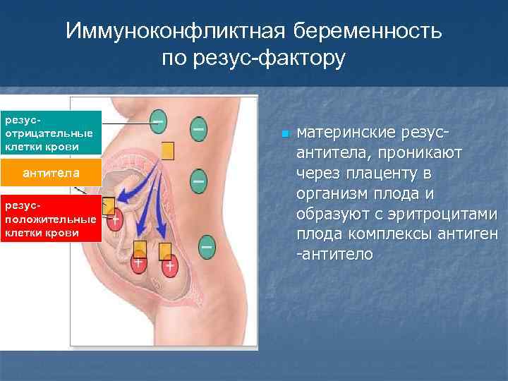 Иммуноконфликтная беременность по резус-фактору резусотрицательные клетки крови антитела резусположительные клетки крови n материнские резусантитела,