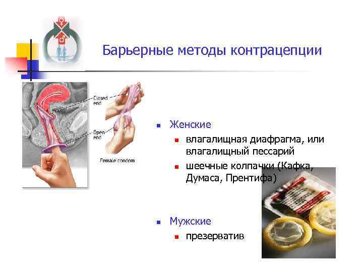 Барьерные методы контрацепции n n Женские n влагалищная диафрагма, или влагалищный пессарий n шеечные