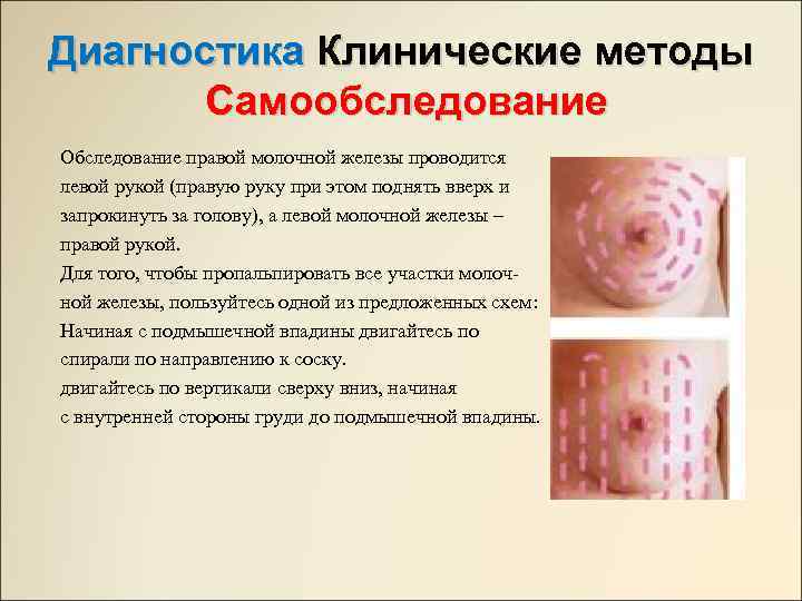 Диагностика Клинические методы Самообследование Обследование правой молочной железы проводится левой рукой (правую руку при