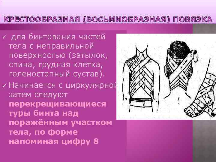 КРЕСТООБРАЗНАЯ (ВОСЬМИОБРАЗНАЯ) ПОВЯЗКА для бинтования частей тела с неправильной поверхностью (затылок, спина, грудная клетка,