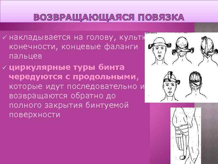 ВОЗВРАЩАЮЩАЯСЯ ПОВЯЗКА накладывается на голову, культю конечности, концевые фаланги пальцев ü циркулярные туры бинта