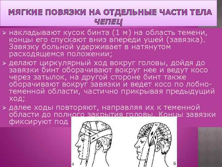МЯГКИЕ ПОВЯЗКИ НА ОТДЕЛЬНЫЕ ЧАСТИ ТЕЛА ЧЕПЕЦ Ø накладывают кусок бинта (1 м) на