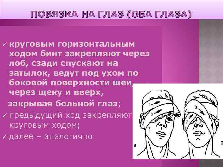 ПОВЯЗКА НА ГЛАЗ (ОБА ГЛАЗА) круговым горизонтальным ходом бинт закрепляют через лоб, сзади спускают