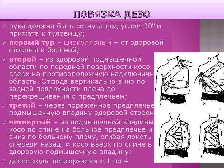 ПОВЯЗКА ДЕЗО ü ü ü рука должна быть согнута под углом 900 и прижата