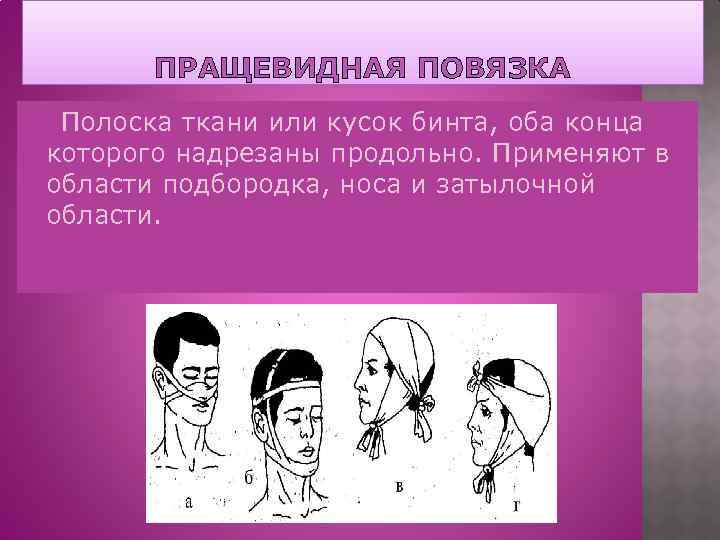 ПРАЩЕВИДНАЯ ПОВЯЗКА Полоска ткани или кусок бинта, оба конца которого надрезаны продольно. Применяют в