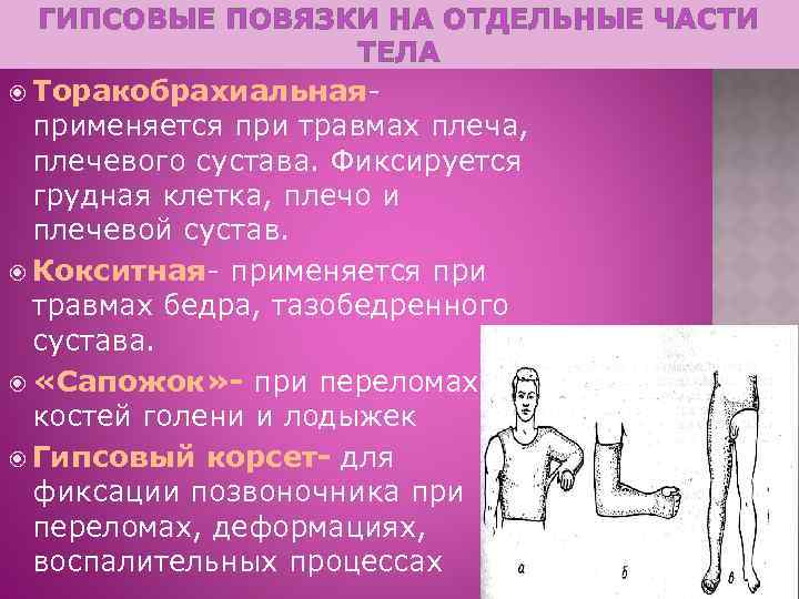 ГИПСОВЫЕ ПОВЯЗКИ НА ОТДЕЛЬНЫЕ ЧАСТИ ТЕЛА Торакобрахиальная- применяется при травмах плеча, плечевого сустава. Фиксируется