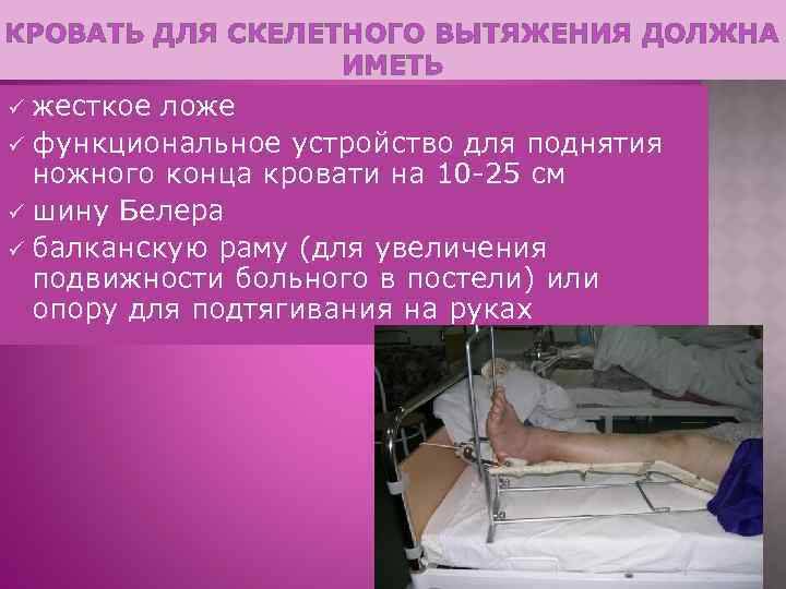 КРОВАТЬ ДЛЯ СКЕЛЕТНОГО ВЫТЯЖЕНИЯ ДОЛЖНА ИМЕТЬ жесткое ложе ü функциональное устройство для поднятия ножного