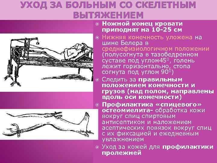 УХОД ЗА БОЛЬНЫМ СО СКЕЛЕТНЫМ ВЫТЯЖЕНИЕМ Ножной конец кровати приподнят на 10 -25 см