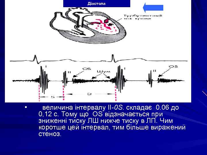 Діастола • величина інтервалу ІІ-0 S. складає 0. 06 до 0, 12 с. Тому