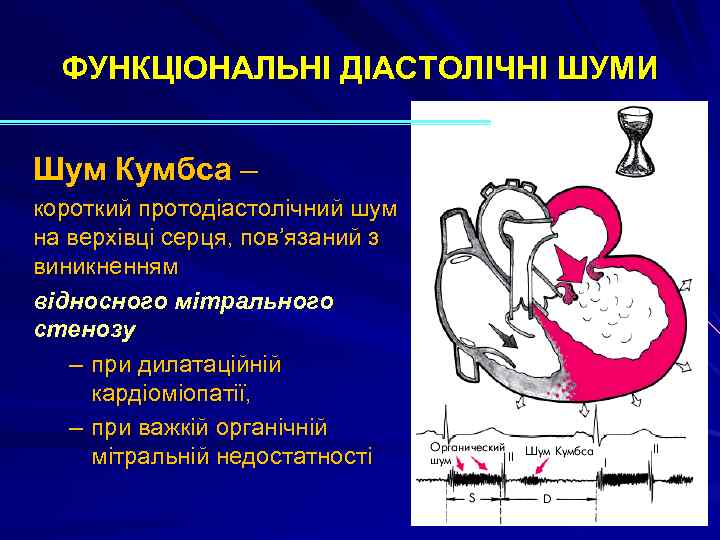 ФУНКЦІОНАЛЬНІ ДІАСТОЛІЧНІ ШУМИ Шум Кумбса – короткий протодіастолічний шум на верхівці серця, пов’язаний з