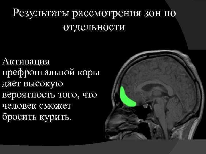 Результаты рассмотрения зон по отдельности Активация префронтальной коры дает высокую вероятность того, что человек