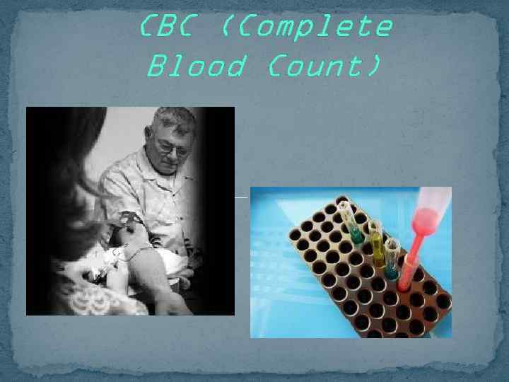 CBC (Complete Blood Count) 