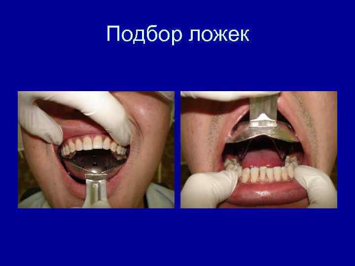 Подбор ложек 