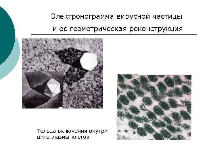 Электронограмма вирусной частицы и ее геометрическая реконструкция Тельца включения внутри цитоплазмы клеток 