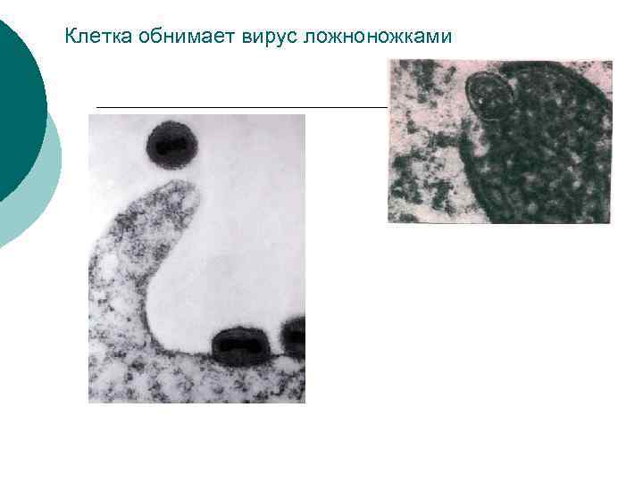 Клетка обнимает вирус ложноножками 