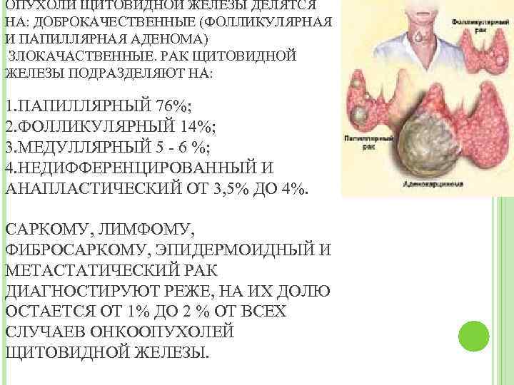 ОПУХОЛИ ЩИТОВИДНОЙ ЖЕЛЕЗЫ ДЕЛЯТСЯ НА: ДОБРОКАЧЕСТВЕННЫЕ (ФОЛЛИКУЛЯРНАЯ И ПАПИЛЛЯРНАЯ АДЕНОМА) ЗЛОКАЧАСТВЕННЫЕ. РАК ЩИТОВИДНОЙ ЖЕЛЕЗЫ