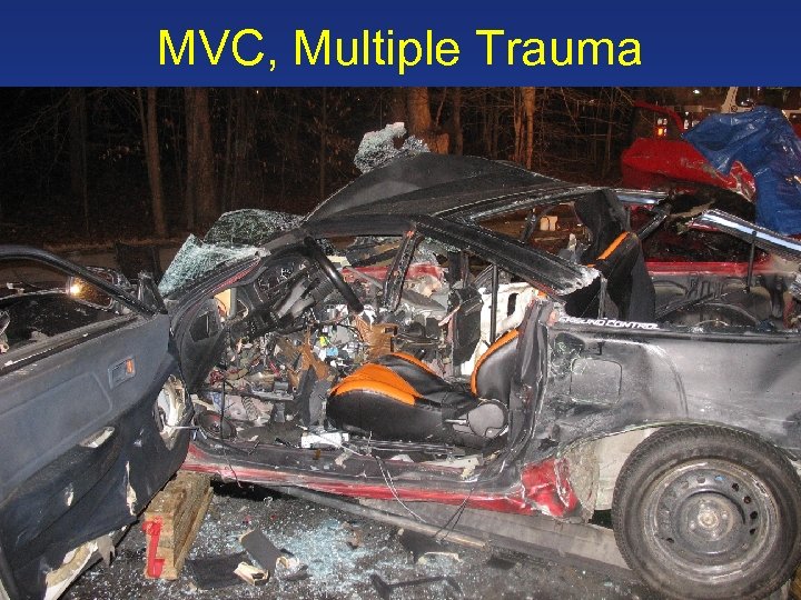 MVC, Multiple Trauma 