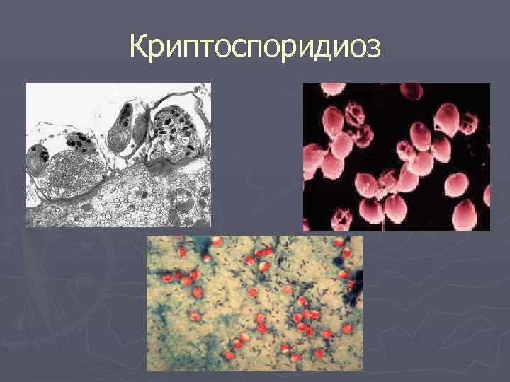 Криптоспоридиоз 