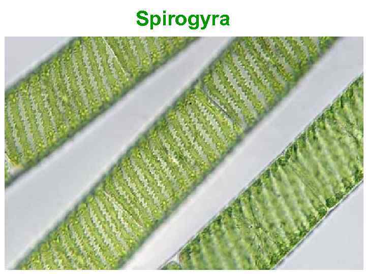 Spirogyra 