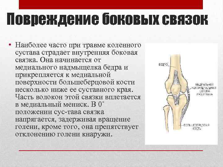 Повреждение боковых связок • Наиболее часто при травме коленного сустава страдает внутренняя боковая связка.