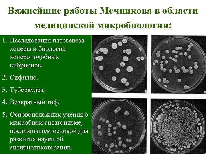 Важнейшие работы Мечникова в области медицинской микробиологии: 1. Исследования патогенеза холеры и биологии холероподобных