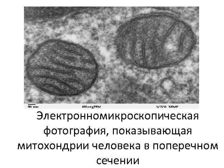 Электронномикроскопическая фотография, показывающая митохондрии человека в поперечном сечении 