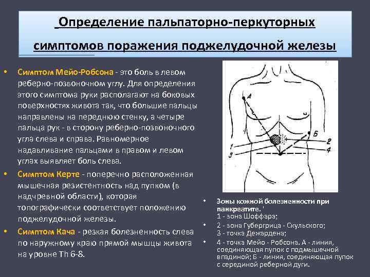 Определение пальпаторно-перкуторных симптомов поражения поджелудочной железы • • • Симптом Мейо-Робсона - это боль