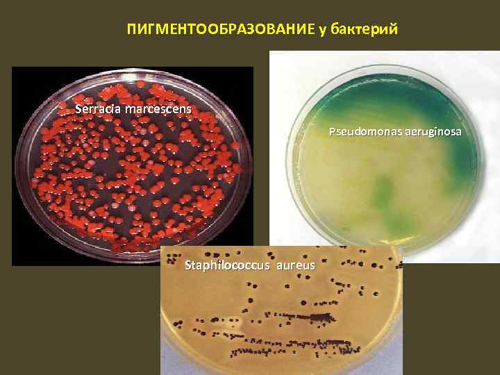 ПИГМЕНТООБРАЗОВАНИЕ у бактерий Serracia marcescens Pseudomonas aeruginosa Staphilococcus aureus 