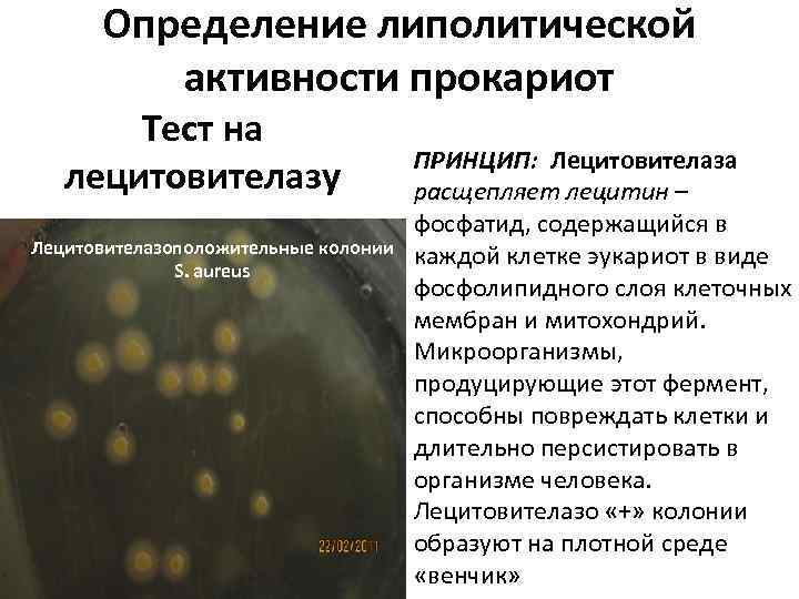 Определение липолитической активности прокариот Тест на лецитовителазу Лецитовителазоположительные колонии S. aureus ПРИНЦИП: Лецитовителаза расщепляет