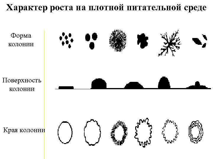Характер роста на плотной питательной среде Форма колонии Поверхность колонии Края колонии 